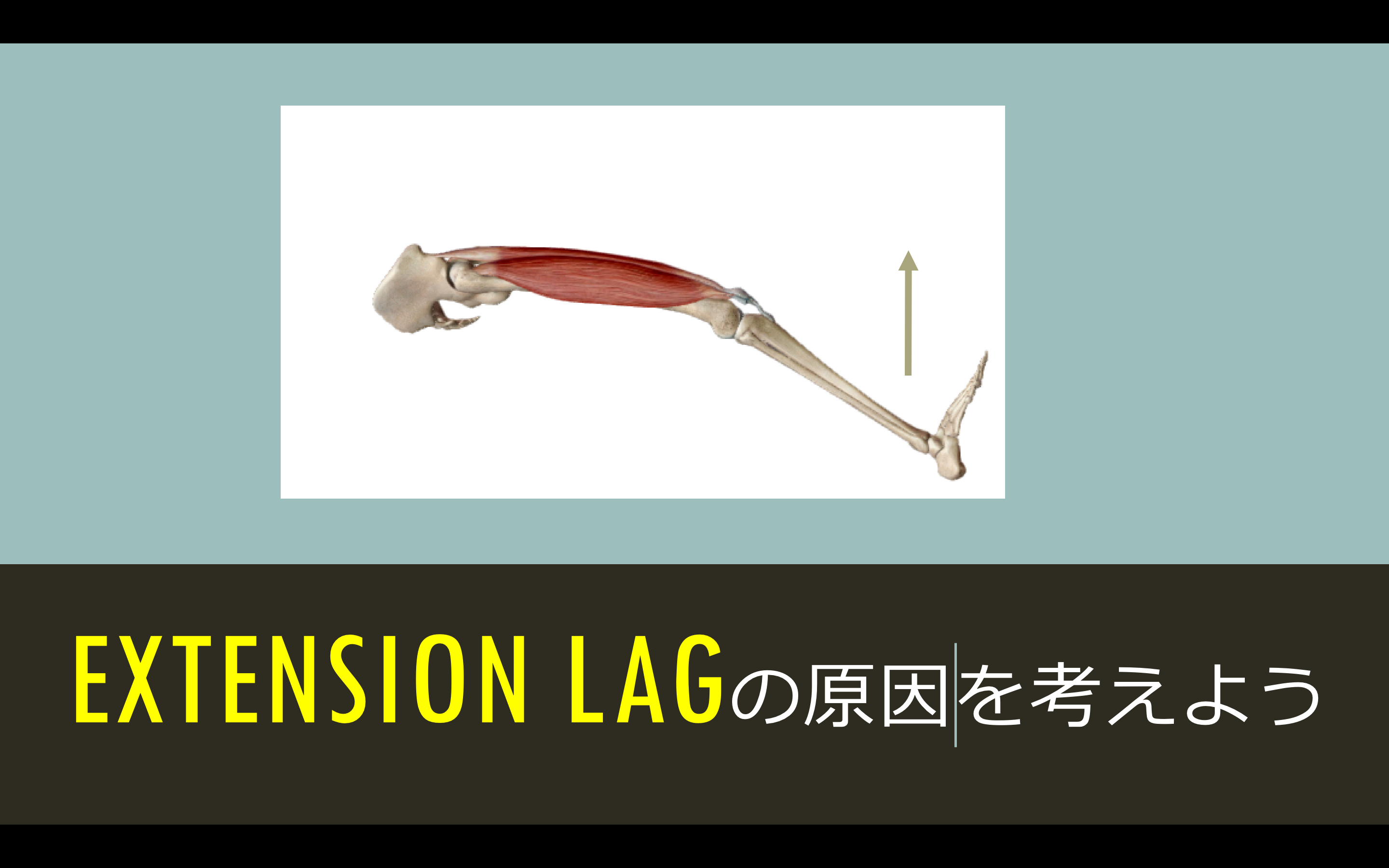 extension lagの原因は内側広筋だけじゃない？膝関節伸展機構のまとめ！ 理学療法士のカラダブログ