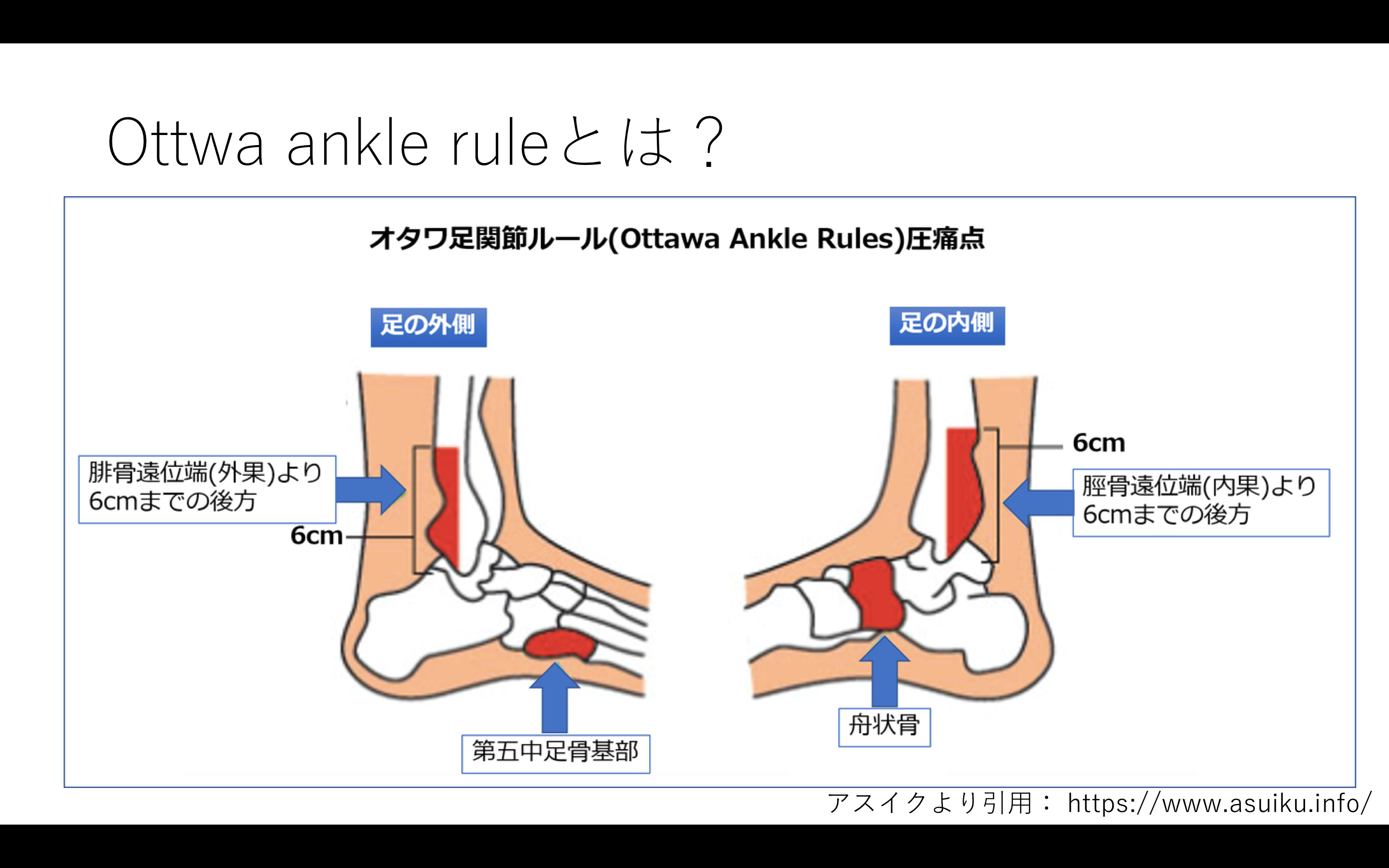 機能解剖から考える足関節捻挫の理学療法評価 治療 リハビリ保存版 Reharock リハロック