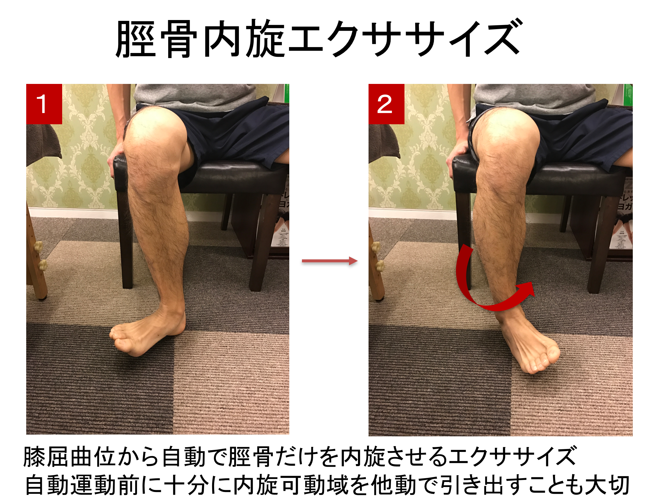 スクリューホームムーブメントのメカニズムと臨床評価とは？膝の痛みとの関係性！ RehaRock〜リハロック〜