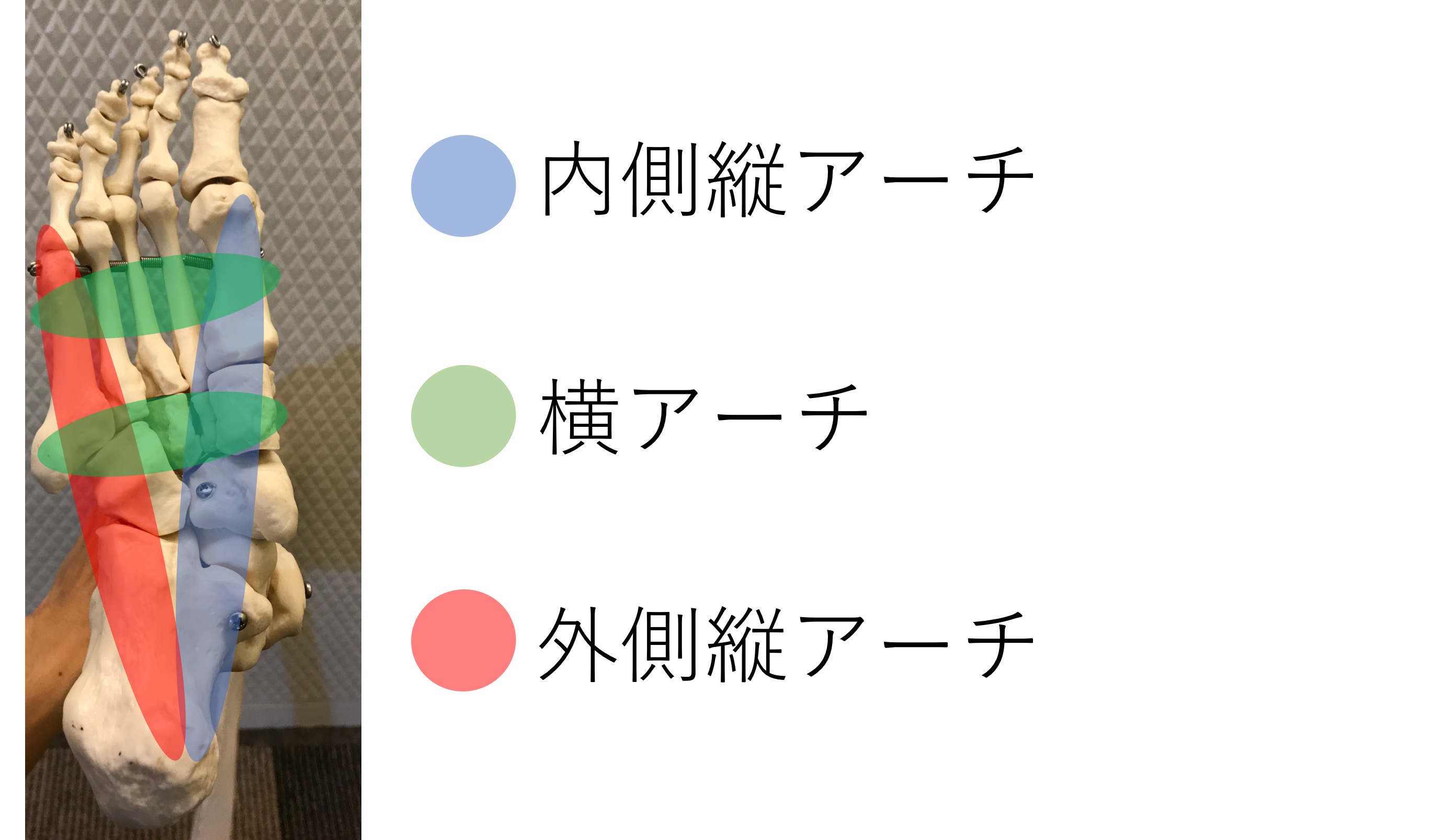 足関節アーチ構造まとめ 内 外側縦アーチ 横アーチの構造と機能からリハビリを考える Reharock リハロック