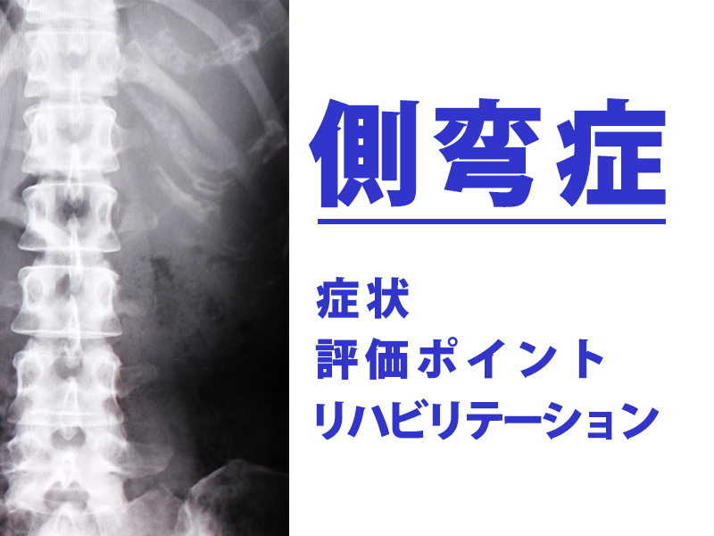 側弯症のリハビリまとめ 手術をしないで治せるの 運動療法の効果と変化 Reharock リハロック